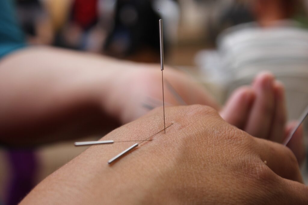 Effectiveness of Acupuncture